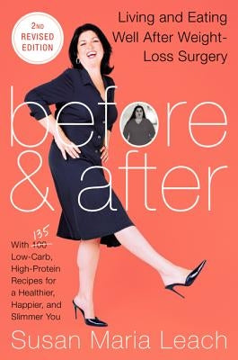 Before & After, Second Revised Edition: Living and Eating Well After Weight-Loss Surgery by Leach, Susan Maria