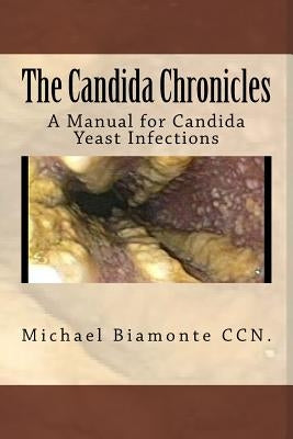 The Candida Chronicles: A Mannual for Candida/Yeast Infections by Biamonte Ccn, Michael C.